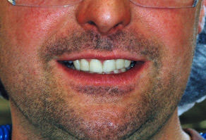 Facial shot cropped after final review and polish