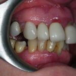 Dental Implant Clinic