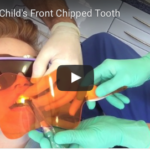mending A Child's Chipped Tooth